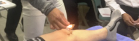 症例検討会
